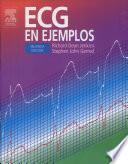 Libro ECG En Ejemplos