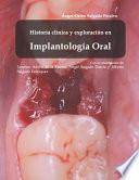 Historía Clínica Y Exploración En Implantología Oral