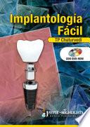 Libro Implantología Fácil