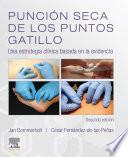 Punción Seca de Los Puntos Gatillo