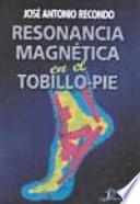 Resonancia Magnética en el Tobillo-Pie