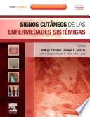 Signos cutáneos de las enfermedades sistémicas 4 ed. © 2011 + Expert Consult